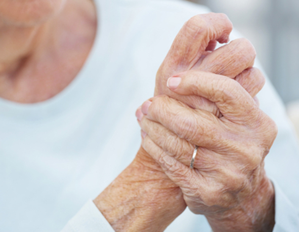 Qu'est-ce que l'arthrose et comment la traiter ? - Pharmacie en